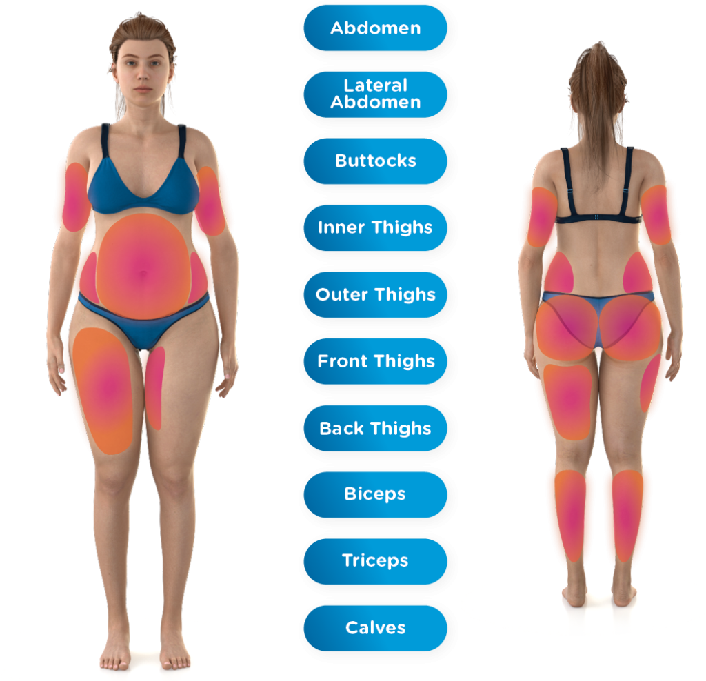 EMSCULPT NEO treatment areas: Abdomen, Lateral Abdomen, Buttocks, Inner Thighs, Outer Thighs, Front Thighs, Back Thighs, Biceps, Triceps, Calves.